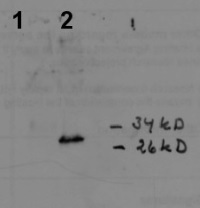 CAH3 | Carbonic anhydrase in the group Antibodies Plant/Algal / Photosynthesis / RUBISCO/Carbon metabolism at Agrisera AB (Antibodies for research) (AS05 073)